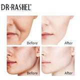 DR RASHEL Anti-aging Moisturizing Complete Facial Serum Set, Pack of 3