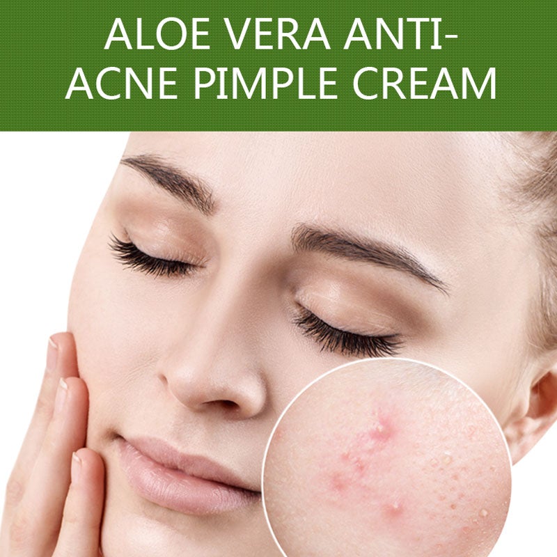 Dr Rashel Aloe Vera Anti acne Pimple Cream, 30ml